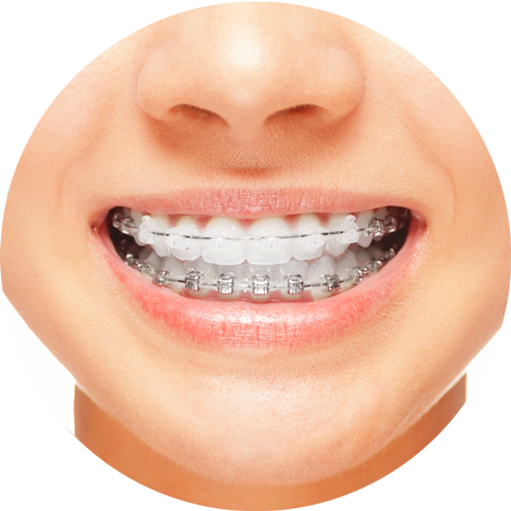 COMPLIMENTARY ORTHODONTIC TREATMENT